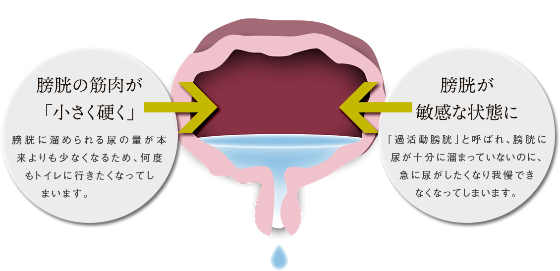 膀胱イラスト