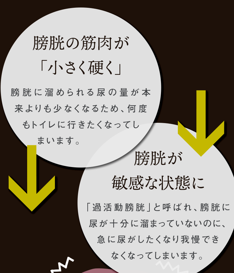 膀胱の筋肉が「小さく硬く」