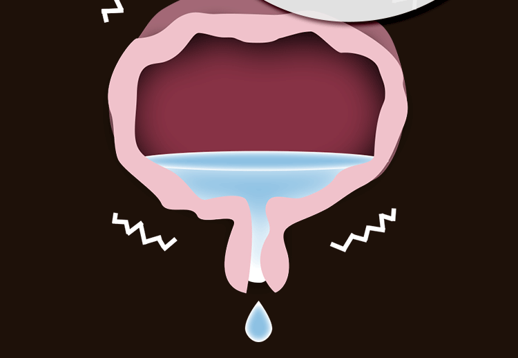 膀胱